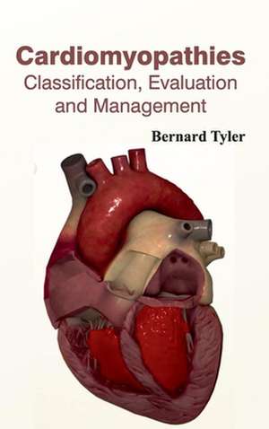 Cardiomyopathies de Bernard Tyler