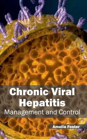 Chronic Viral Hepatitis de Amelia Foster