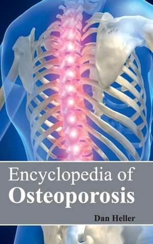 Encyclopedia of Osteoporosis de Dan Heller