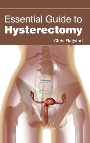 Essential Guide to Hysterectomy de Chris Flagstad