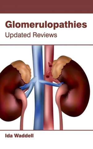 Glomerulopathies de Ida Waddell