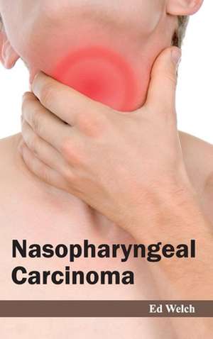 Nasopharyngeal Carcinoma de Ed Welch