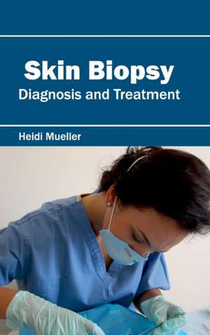 Skin Biopsy de Heidi Mueller