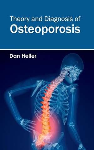 Theory and Diagnosis of Osteoporosis de Dan Heller