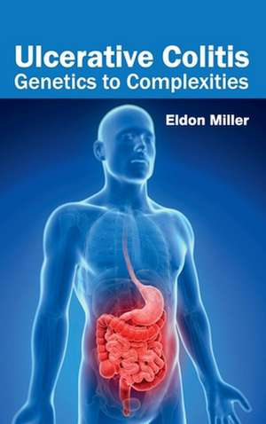 Ulcerative Colitis de Eldon Miller