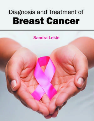 Diagnosis and Treatment of Breast Cancer de Sandra Lekin