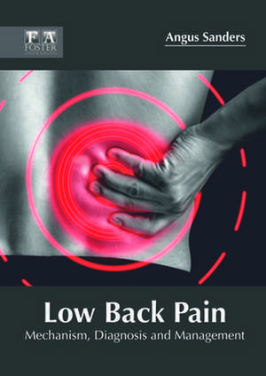 Low Back Pain de Angus Sanders