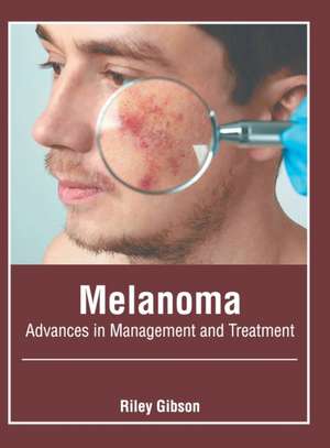 Melanoma: Advances in Management and Treatment de Riley Gibson