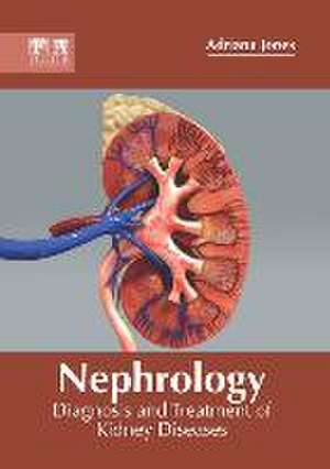 Nephrology: Diagnosis and Treatment of Kidney Diseases de Adriana Jones