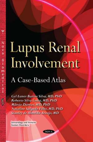 Lupus Renal Involvement: A Case-Based Atlas de Gyl Eanes Barros Silva