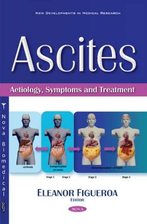 Ascites: Aetiology, Symptoms & Treatment de Eleanor Figueroa