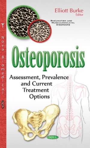 Osteoporosis: Assessment, Prevalence & Current Treatment Options de Elliott Burke