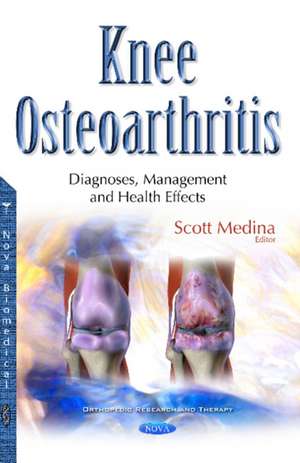 Knee Osteoarthritis: Diagnoses, Management & Health Effects de Scott Medina