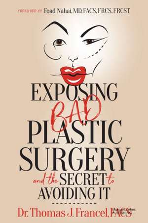 Exposing Bad Plastic Surgery de FACS Thomas J. Francel