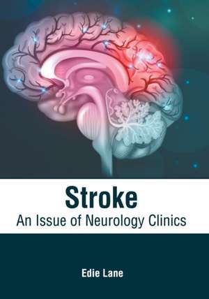 Stroke: An Issue of Neurology Clinics de Edie Lane