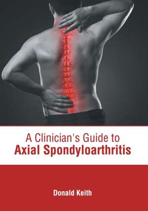 A Clinician's Guide to Axial Spondyloarthritis de Donald Keith