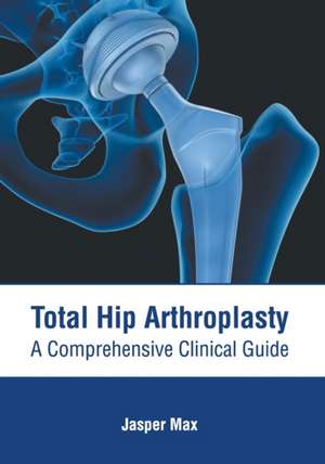 Total Hip Arthroplasty: A Comprehensive Clinical Guide de Jasper Max