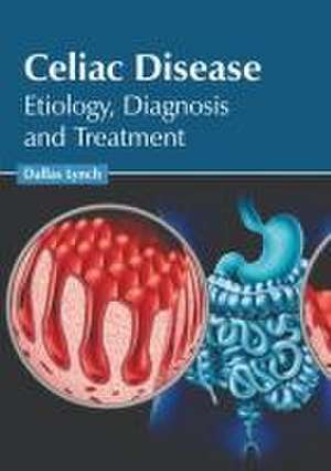 Celiac Disease: Etiology, Diagnosis and Treatment de Dallas Lynch