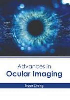 Advances in Ocular Imaging de Bryce Strong