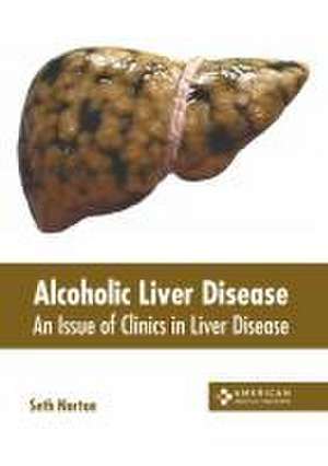 Alcoholic Liver Disease: An Issue of Clinics in Liver Disease de Seth Norton