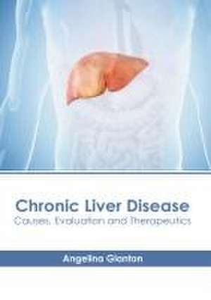 Chronic Liver Disease: Causes, Evaluation and Therapeutics de Angelina Glanton