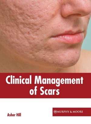 Clinical Management of Scars de Asher Hill