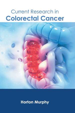 Current Research in Colorectal Cancer de Horton Murphy