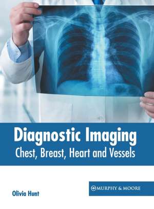 Diagnostic Imaging: Chest, Breast, Heart and Vessels de Olivia Hunt