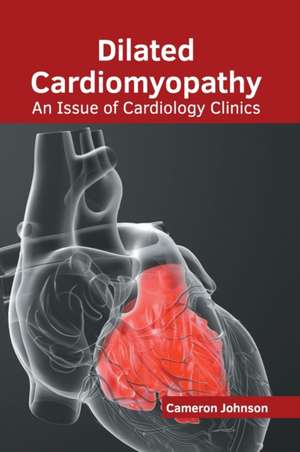 Dilated Cardiomyopathy: An Issue of Cardiology Clinics de Cameron Johnson