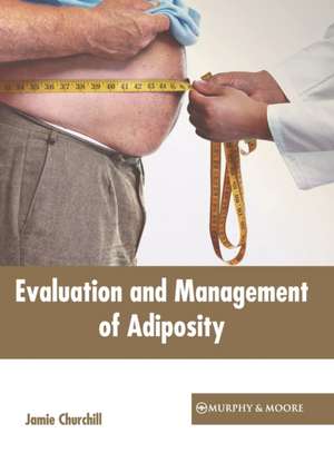 Evaluation and Management of Adiposity de Jamie Churchill