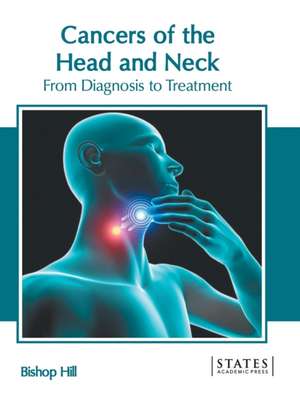 Cancers of the Head and Neck: From Diagnosis to Treatment de Bishop Hill