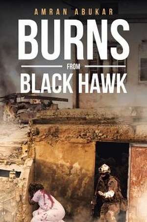 Burns from Black Hawk de Amran Abukar