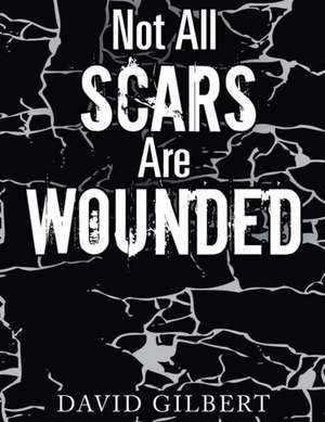 Gilbert, D: Not All Scars Are Wounded