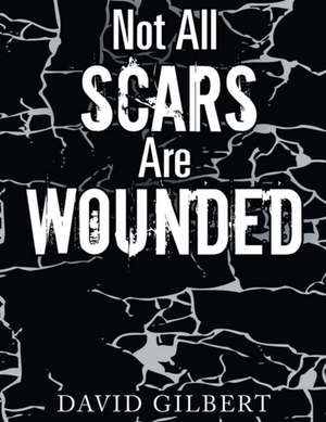 Not All Scars Are Wounded de David Ray Gilbert