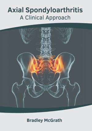 Axial Spondyloarthritis: A Clinical Approach de Bradley McGrath