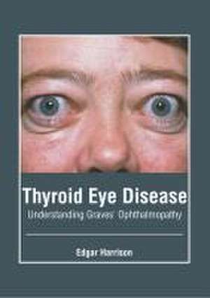 Thyroid Eye Disease: Understanding Graves' Ophthalmopathy de Edgar Harrison