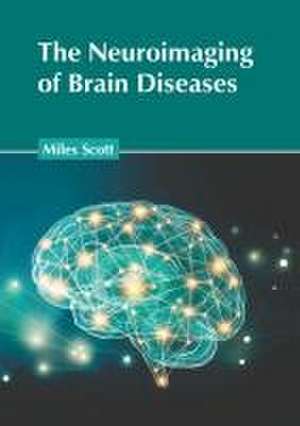 The Neuroimaging of Brain Diseases de Miles Scott