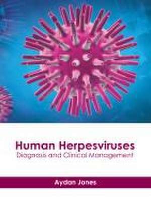 Human Herpesviruses: Diagnosis and Clinical Management de Aydan Jones