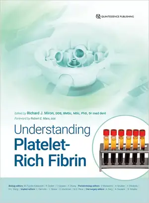 Understanding Platelet-Rich Fibrin de Richard J. Miron