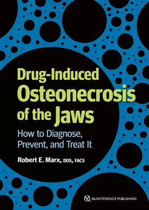 Drug-Induced Osteonecrosis of the Jaws: How to Diagnose, Prevent, and Treat It de Robert E. Marx