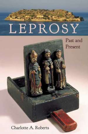 Leprosy de Charlotte A. Roberts