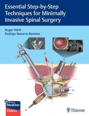 Essential Step–by–Step Techniques for Minimally Invasive Spinal Surgery de Roger Hartl