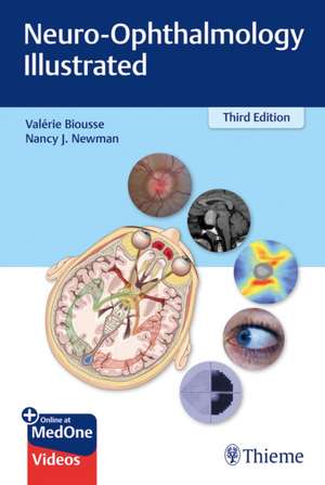 Neuro–Ophthalmology Illustrated de Valerie Biousse