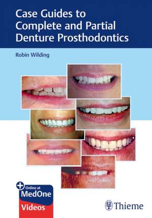 Case Guides to Complete and Partial Denture Prosthodontics de Robin Wilding