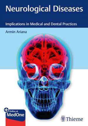 Neurological Diseases: Implications in Medical and Dental Practices de Armin Ariana