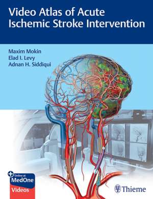 Video Atlas of Acute Ischemic Stroke Intervention de Maxim Mokin