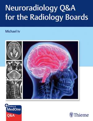 Neuroradiology Q&A for the Radiology Boards de M Iv