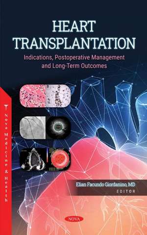 Heart Transplantation: Indications, Postoperative Management and Long-Term Outcomes de Elian Facundo Giordanino