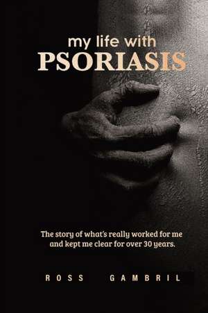 my life with PSORIASIS de Ross Gambril