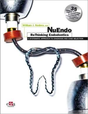 William J Nudera: NuEndo ReThinking Endodontics